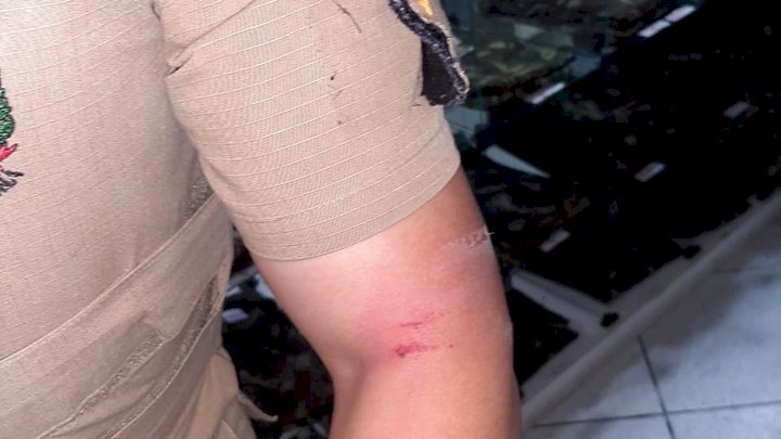 Policial foi atingido por um golpe de foice | Foto: PM/Divulgação